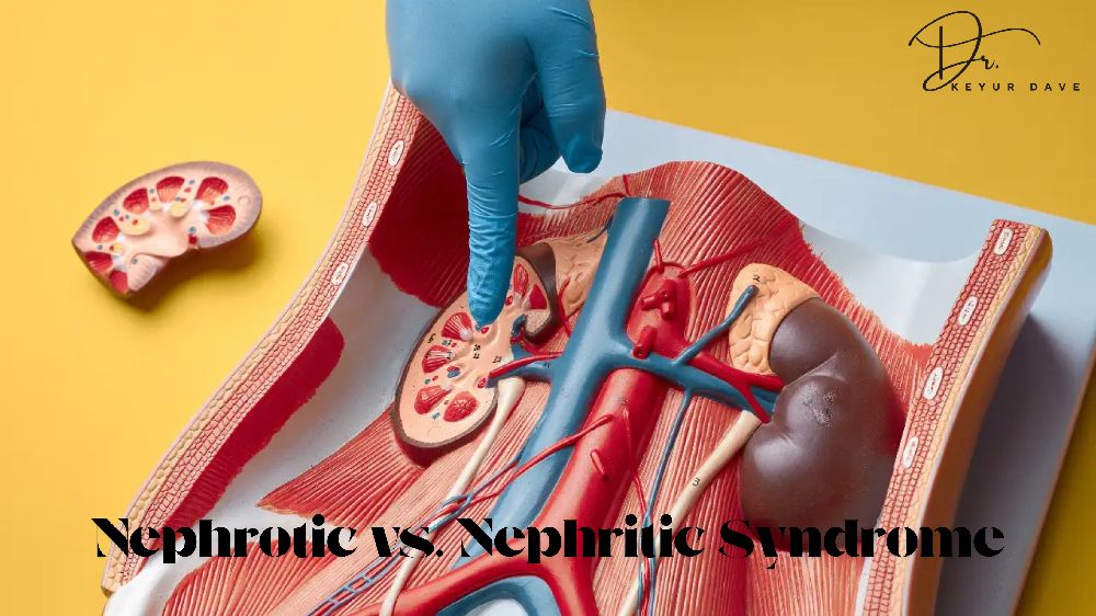 Nephrotic vs. Nephritic Syndrome Understanding the Key Differences (1)-Copy-1.jpg